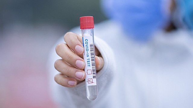 La Región de Murcia registra 1.279 nuevos casos de coronavirus en las últimas 24 horas - 1, Foto 1