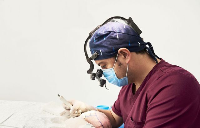 La Clínica Dr. Bruno Jacobovski facilita injertos capilares sin coste a los accidentados por quemaduras - 1, Foto 1