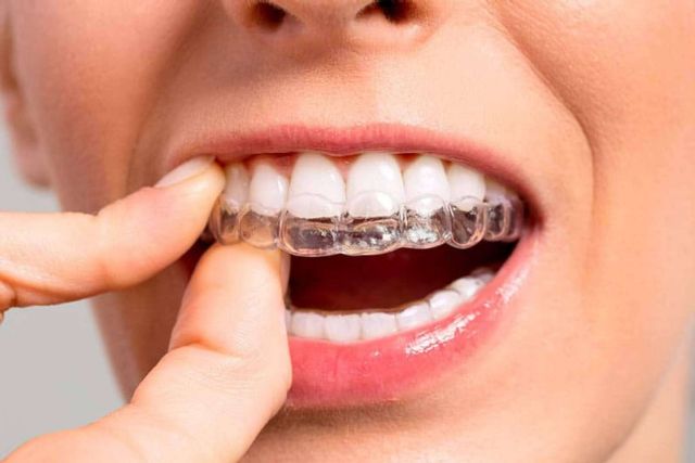 La Clínica Dental Ahoa ofrece la ortodoncia invisible con Invisalign® - 1, Foto 1