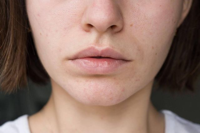 Tratar y prevenir las manchas en la piel en verano, por Farmacia Laura Garín - 1, Foto 1