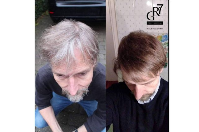 Restauración del color del cabello natural para disimular las canas con GR-7 - 1, Foto 1