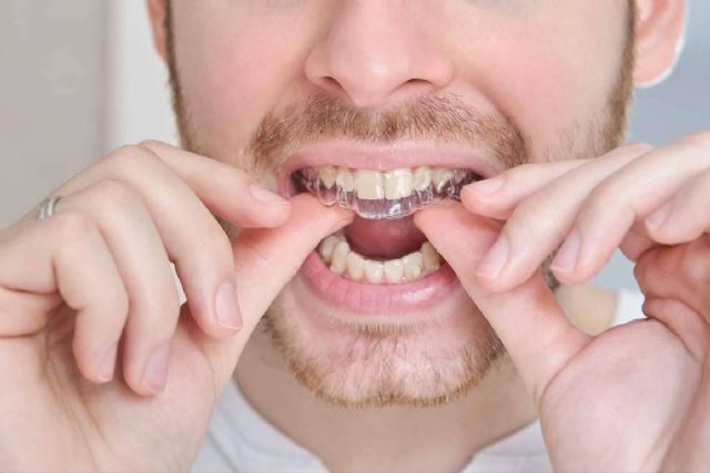 Beneficios de la ortodoncia invisible, por Clínicas Dental Bell - 1, Foto 1