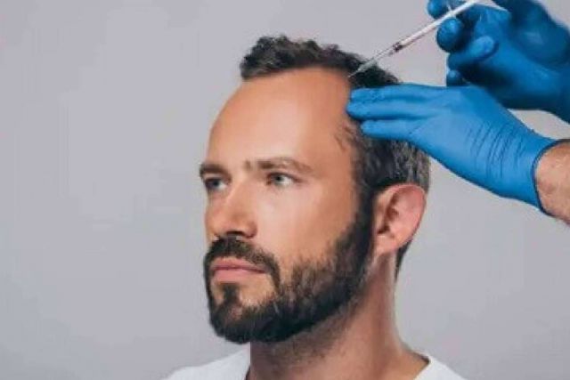 Mesoterapia capilar, tratamiento para la caída del pelo - 1, Foto 1