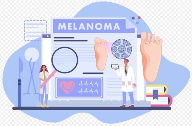 En el Día del melanoma, los podólogos recuerdan la prevención como factor clave para la detección precoz - 1, Foto 1