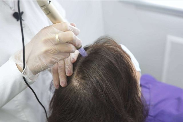 Tratar la alopecia femenina con el tratamiento bioestimulación de IMD Instituto Médico Dermatológico - 1, Foto 1