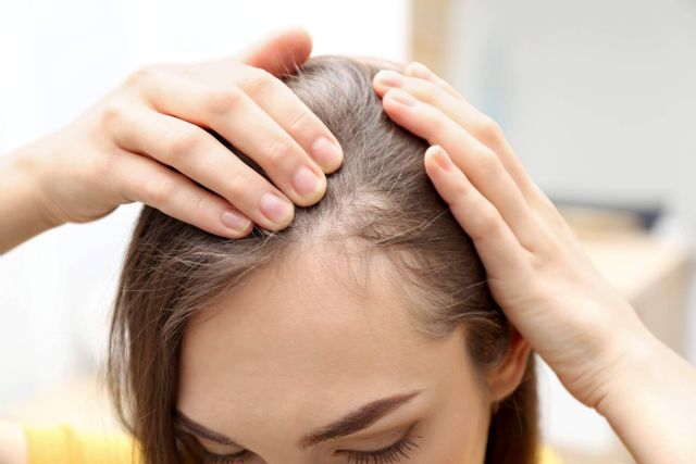 Cómo combatir la alopecia femenina, el método de Capilar Innovation Clinic - 1, Foto 1