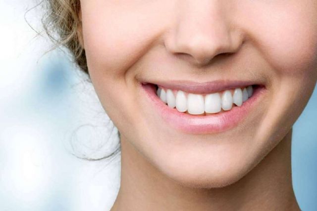 En qué consiste la cirugía de sonrisa gingival - 1, Foto 1