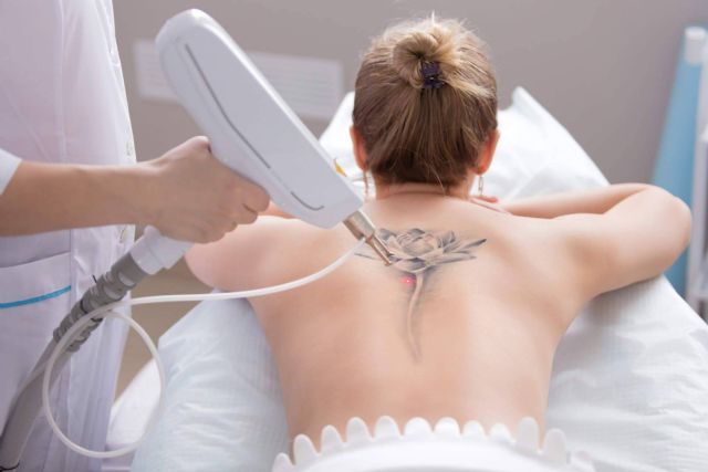 Centro Médico El Pilar dispone de las últimas tecnologías para eliminar tatuajes - 1, Foto 1