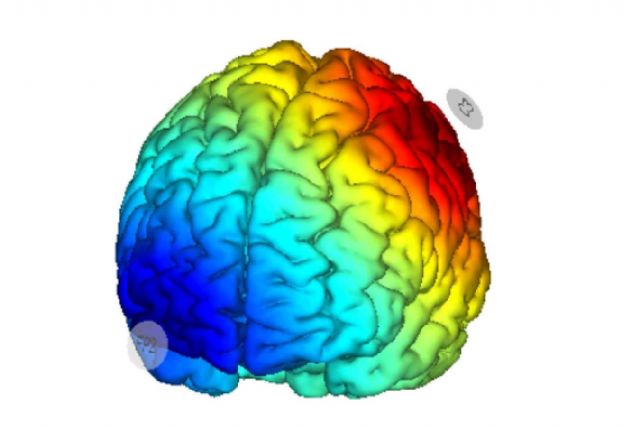 Avances en el tratamiento de la fibromialgia mediante estimulación cerebral no invasiva - 1, Foto 1