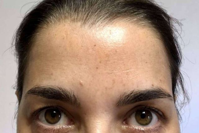 Clínica Amalfi ofrece un tratamiento de rejuvenecimiento facial para lucir un aspecto joven y natural - 1, Foto 1