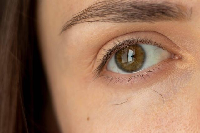 El Doctor Jesús Mora y Capilar Innovation Clinic explican por qué se cae el pelo de las cejas - 1, Foto 1