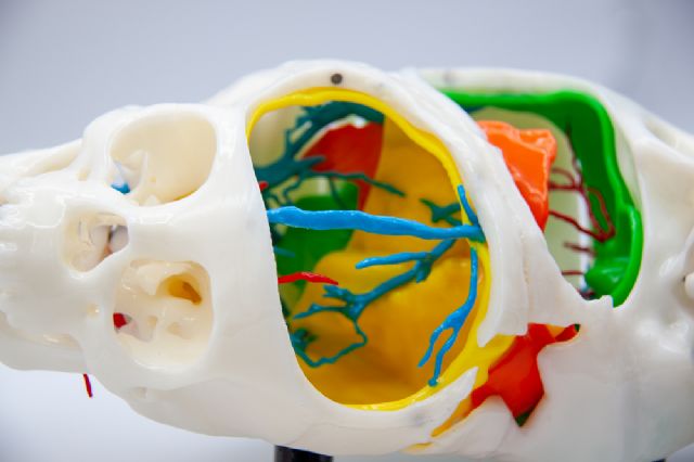 Tecnología 3D española de Cella ayuda a separar con éxito a dos gemelas egipcias - 1, Foto 1