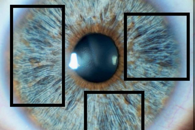 Cómo afecta al brillo de los ojos el colágeno del iris - 1, Foto 1