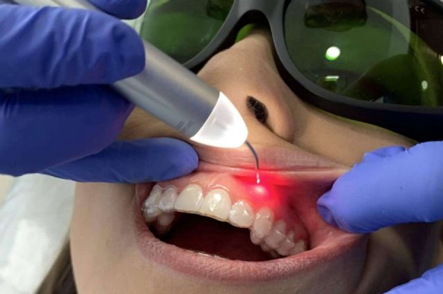 Las últimas tecnologías de estética dental con Dental Implantologie - 1, Foto 1