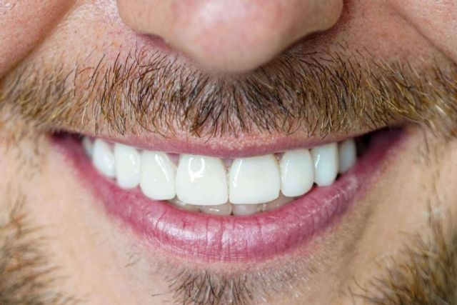 Denty Dent ayuda a mejorar la sonrisa con tratamientos de estética dental - 1, Foto 1