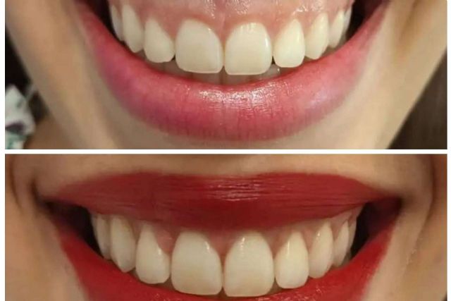 Medicina estética facial y dental para una sonrisa perfecta, con Clínica Calvo de Mora - 1, Foto 1