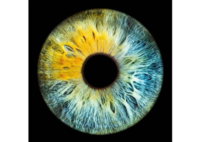 El color de los ojos puede cambiar por enfermedades metabólicas, según una advertencia de la clínica Eyecos - 1, Foto 1