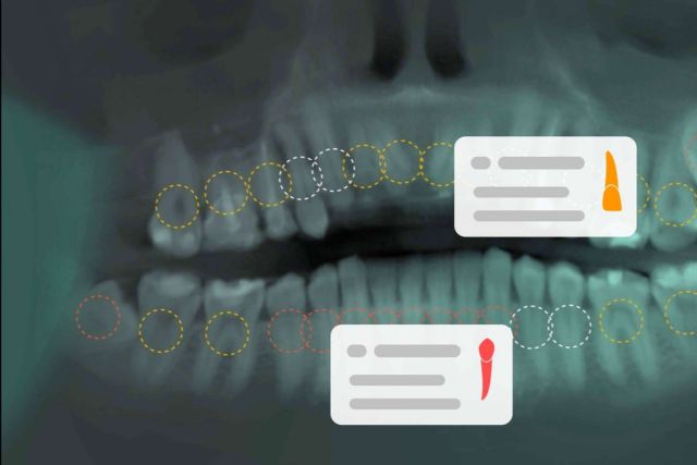 Dentomo trae la inteligencia artificial al ámbito de la odontología - 1, Foto 1