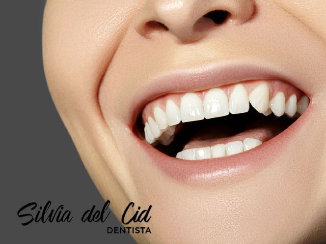 Clínica Dental Silvia del Cid en Torremolinos: innovando en odontología estética - 1, Foto 1