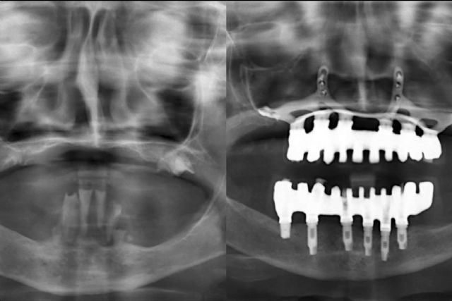 La Clínica Calvo de Mora en Madrid cuenta con expertos en implantes dentales - 1, Foto 1