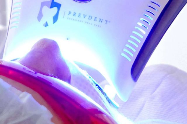 Lograr una apariencia radiante de la dentadura gracias al blanqueamiento dental avanzado con luz LED - 1, Foto 1