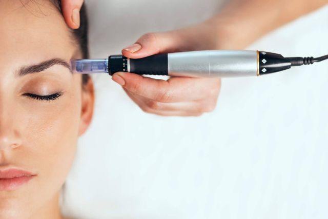 Eliminar pequeñas cicatrices y mejorar el aspecto de la piel con dermapen de G&G Beauty en ojeras y en cicatrices - 1, Foto 1