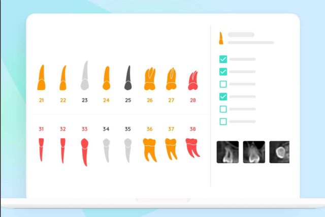 El diagnóstico potenciado por inteligencia artificial que revoluciona la práctica odontológica, Dentomo - 1, Foto 1