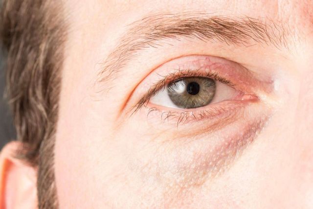 Innovación en el cuidado masculino; el tratamiento Banzeye para las ojeras - 1, Foto 1