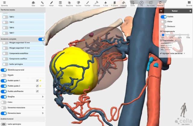 La integración de la IA en modelos 3D permitirá detectar anomalías congénitas en niños, según expertos del Congreso de la SECP - 1, Foto 1