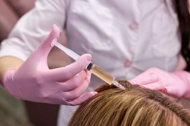 El tratamiento del Doctor Jesús Aníbal Mora previene la alopecia femenina - 1, Foto 1