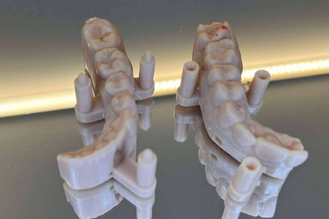 Dentinova aplica tecnología avanzada 3D para recuperar la sonrisa - 1, Foto 1