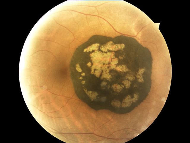 Orduna e-Learning y Cione anuncian los ganadores del Concurso de Fotografía para Ópticos- Optometristas - 1, Foto 1