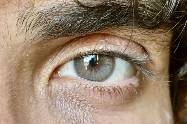 El color de ojos puede cambiarse con el tratamiento de Eyecos - 1, Foto 1