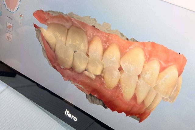 Clínicas Nobel transforma el diagnóstico dental con simulaciones avanzadas en tiempo real - 1, Foto 1