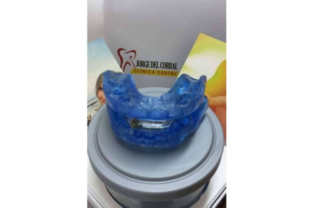 El dispositivo de avance mandibular, la solución para la apnea del sueño y los ronquidos, disponible en Hortaleza - 1, Foto 1