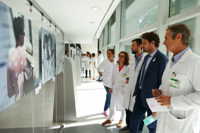 El hospital Reina Sofía acoge una exposición fotográfica sobre los efectos del sol en la piel - 1, Foto 1