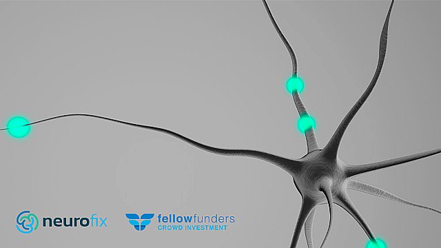 Neurofix abre una ronda de financiación para desarrollar su nuevo fármaco contra el dolor neuropático - 1, Foto 1