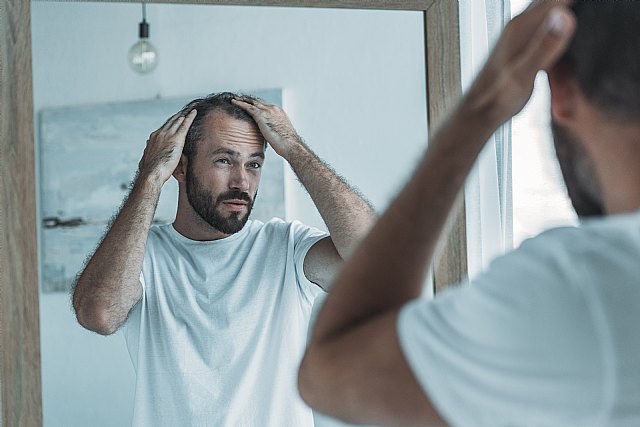 La alopecia androgenética, principal causa de caída del cabello entre el 80% de la población - 1, Foto 1