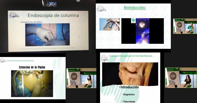 Fraternidad-Muprespa forma en técnicas pioneras a sus profesionales de traumatología - 1, Foto 1