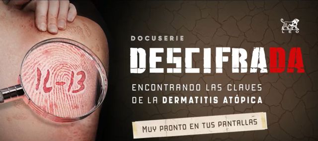 LEO Pharma y la Asociación de Afectados por la Dermatitis Atópica lanzan DescifraDA, una serie documental sobre esta enfermedad - 1, Foto 1