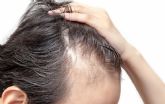 Farmacia Market, contra la alopecia: hasta un 50% de descuentos en su gama de productos anticada