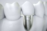 La implantologa dental de carga inmediata de Clnica Dental Ahoa