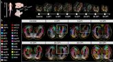 El BGI crea el Primer Atlas Espaciotemporal de Regeneracin del Cerebro del mundo