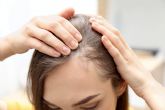 Especialistas en cualquier tipo de alopecia femenina en la clnica Capilar Innovation Clinic