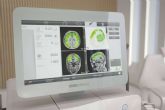 Clnica DKF innova en el tratamiento del Alzheimer en fase temprana