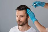 Los tratamientos de mesoterapia, una alternativa muy recomendada para las personas que sufren alopecia segn el doctor Jesus Mora