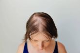 Alopecia femenina. ?Cmo detectarla y qu tratamientos son los adecuados?