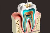 Ozonoterapia en odontologa, una opcin innovadora para la salud bucal