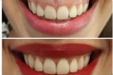 Medicina esttica facial y dental para una sonrisa perfecta, con Clnica Calvo de Mora