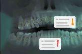 Dentomo trae la inteligencia artificial al mbito de la odontologa